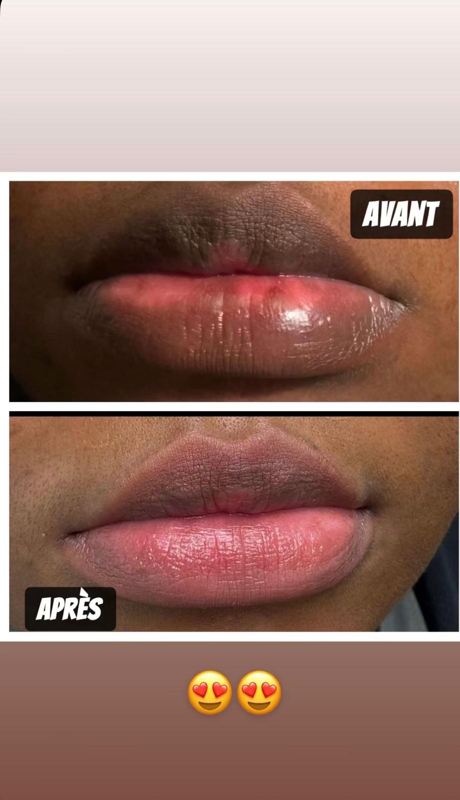 Kit PINK LIPS/ Peeling lèvres